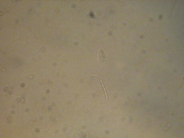 Spirostomum sp. ???